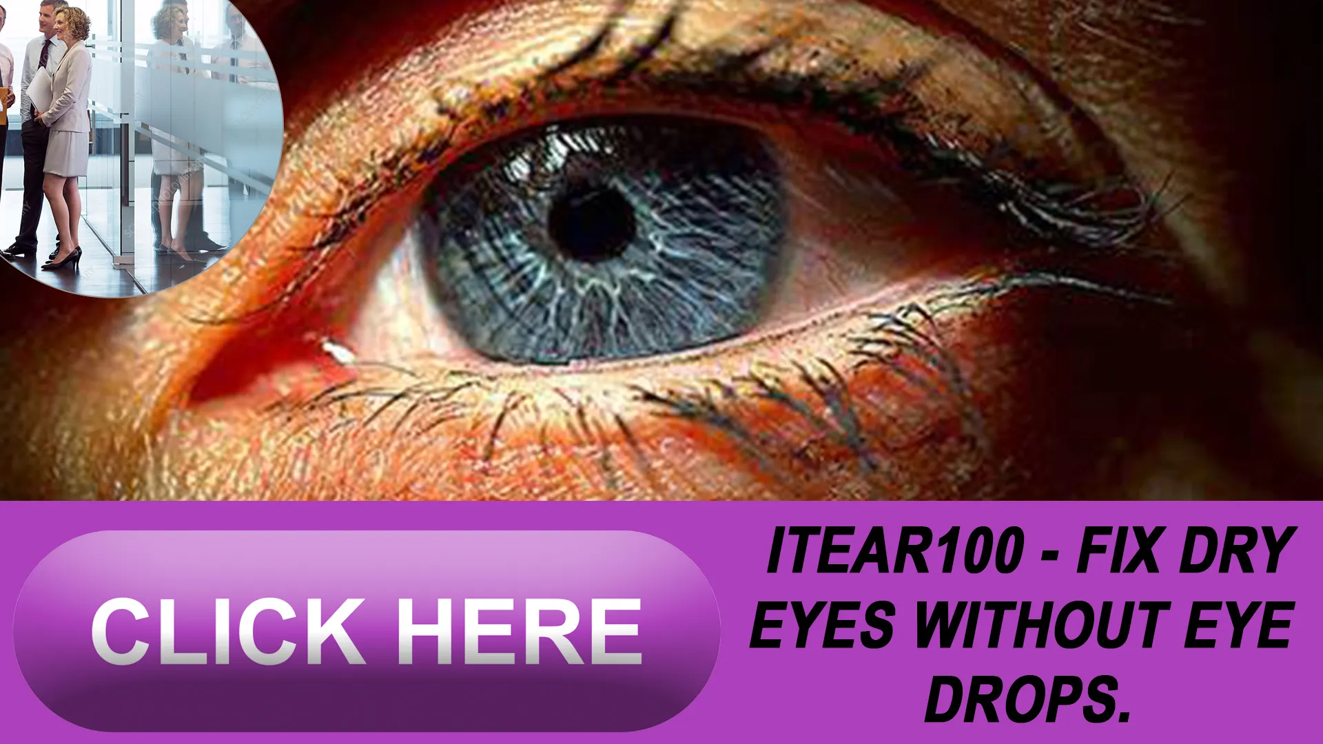 Personalizing Your Dry Eye Treatment