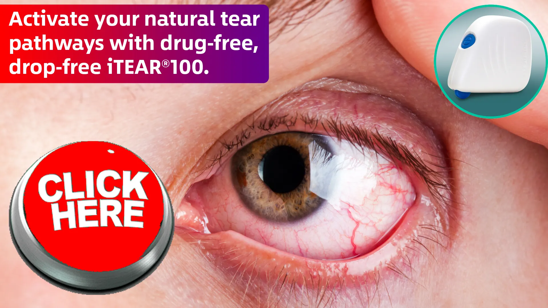 Olympic Ophthalmics



 Introduces the iTEAR100: Dry Eye